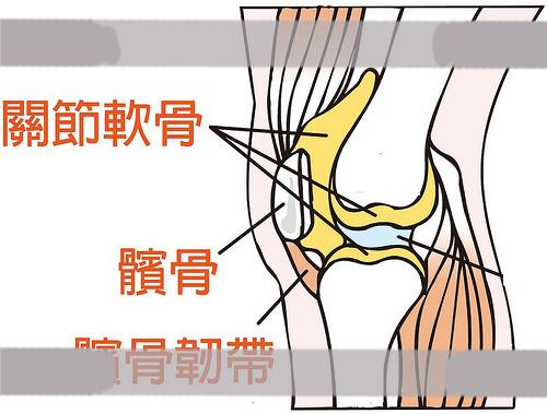 关节软骨、髌骨、髌骨韧带位置图